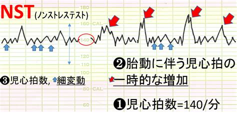 胎心音基準線